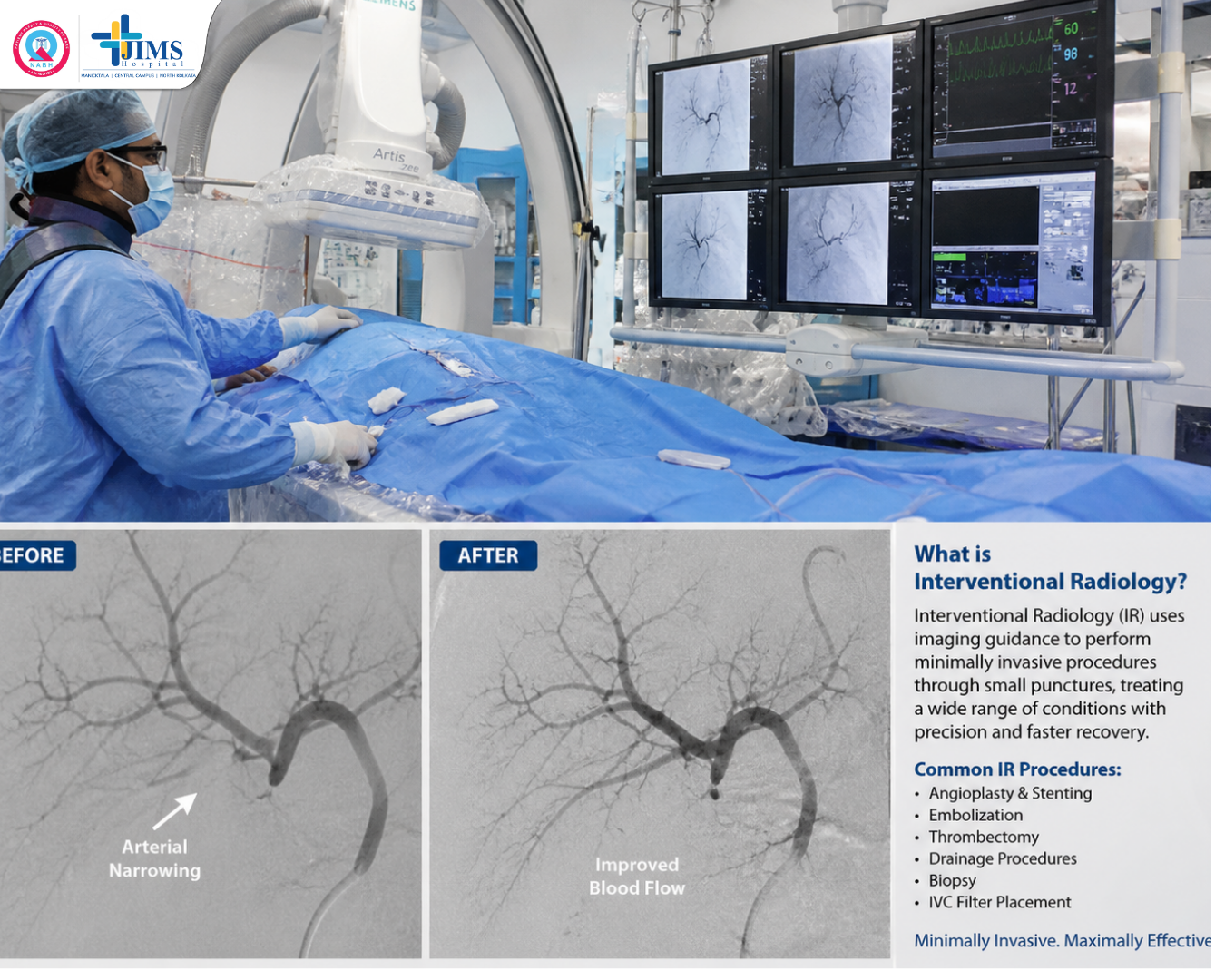 Intervention Radiology
